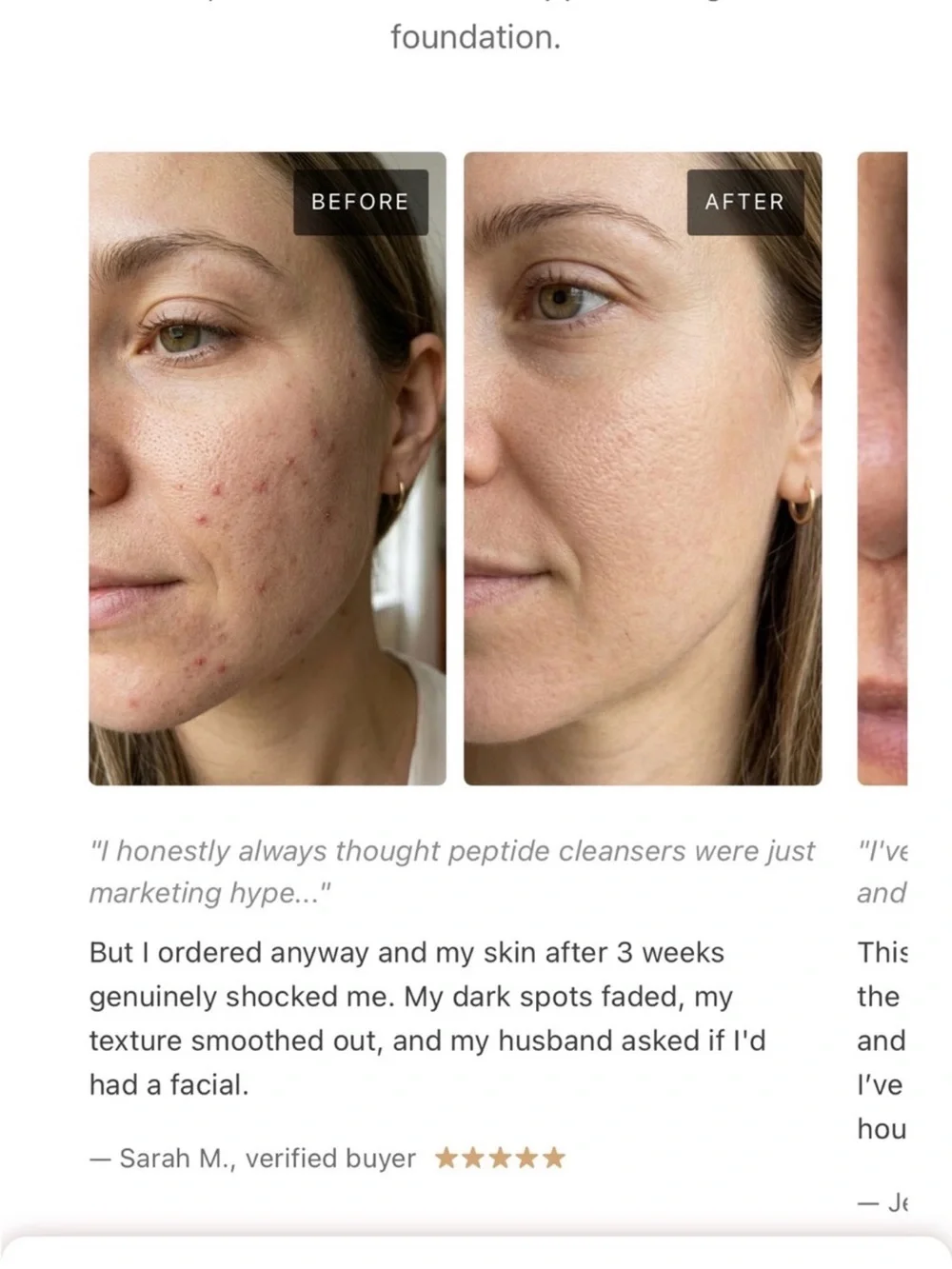 KOA LIFE Peptide Complete Skin Transformation — Rose Gold Set